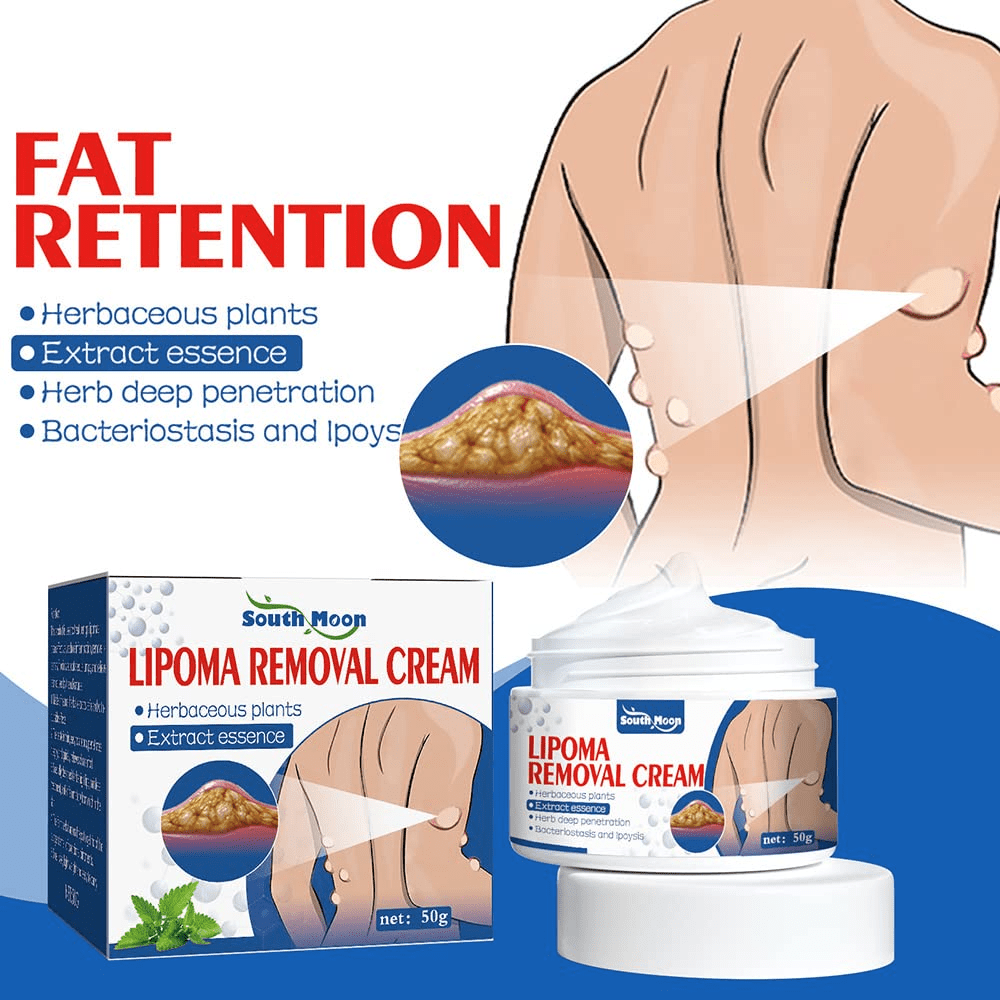 SS Herbal Lipoma Removal Cream (50gm)