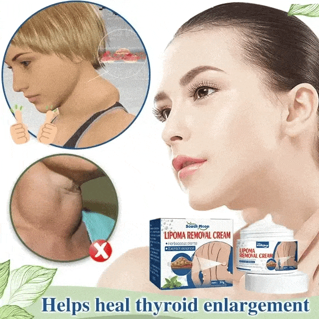 SS Herbal Lipoma Removal Cream (50gm)